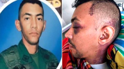 El primer teniente Mogollón Velasquez antes y después de ser lanzado desde un vehículo en marcha