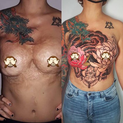 También se operó las mamas para ponerse implantes y se tatuó los pezones. 